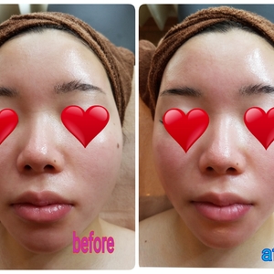 パワーレメディフェイシャルbefore、after！
